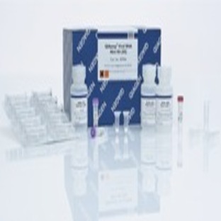 QIAamp Viral RNA Mini Kit (250)