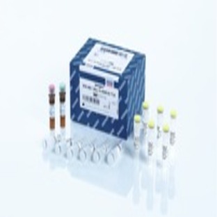 ipsogen BCR-ABL1 Mbcr IS-MMR Kit (24)